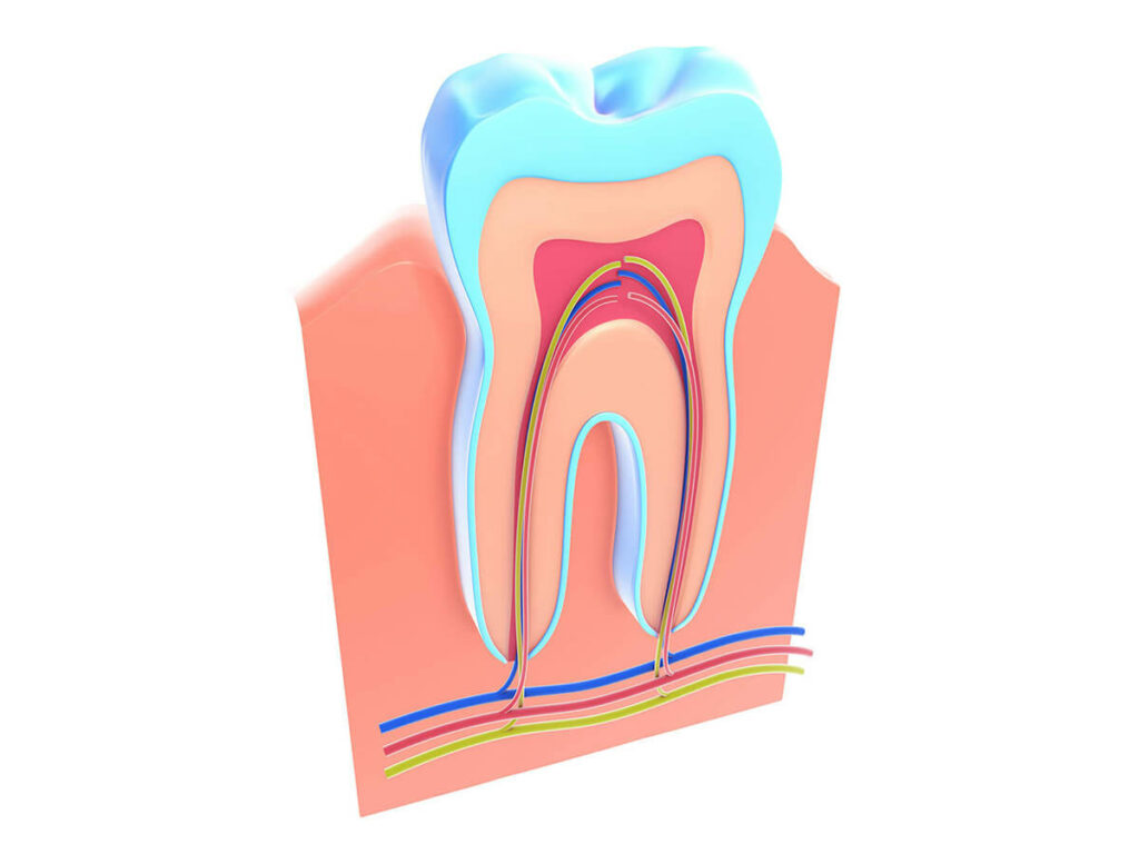 root canal treatment graphic