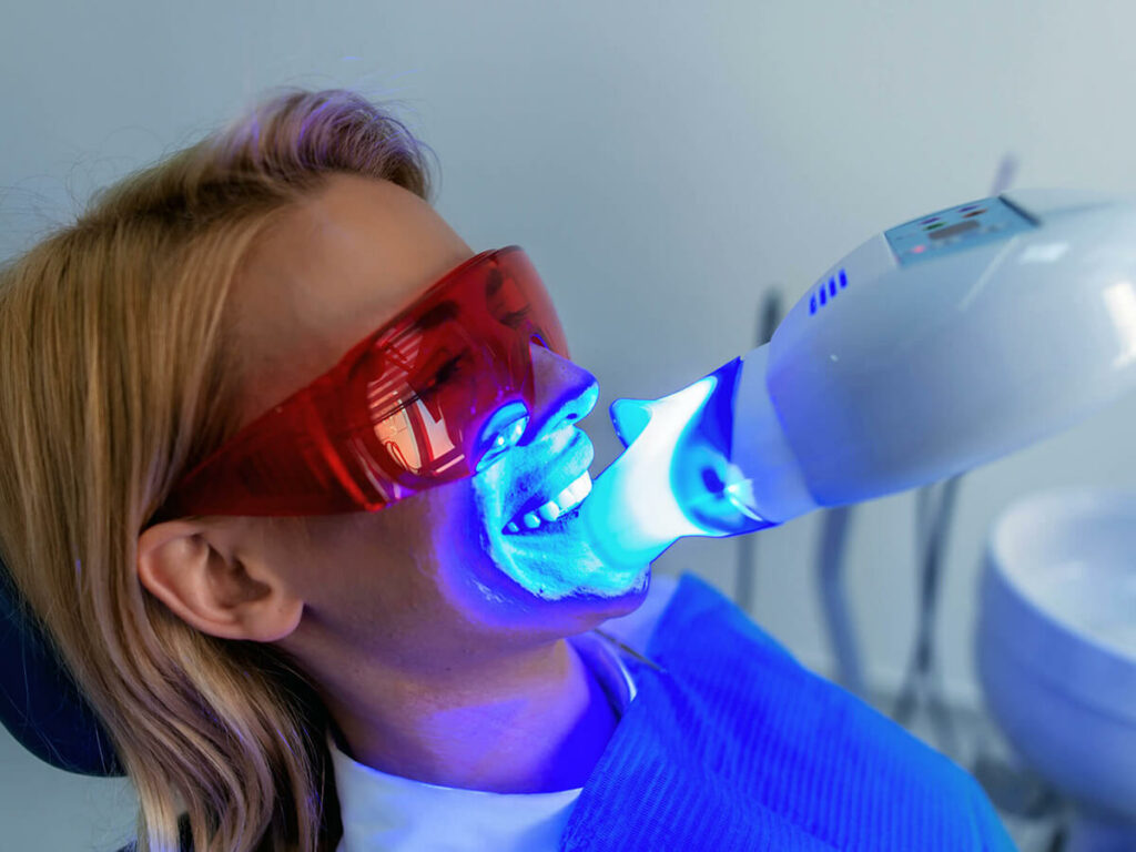 teeth whitening dental service