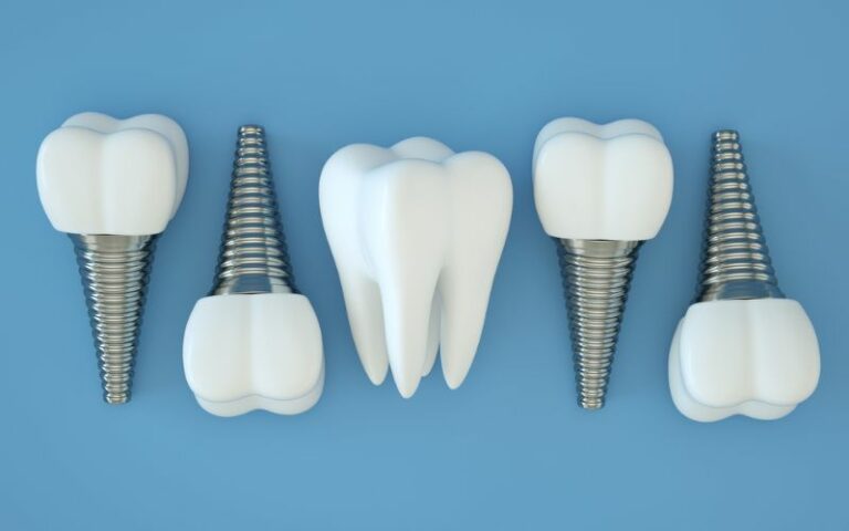 individual dental implants