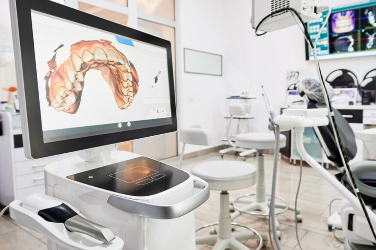 cerec scanner