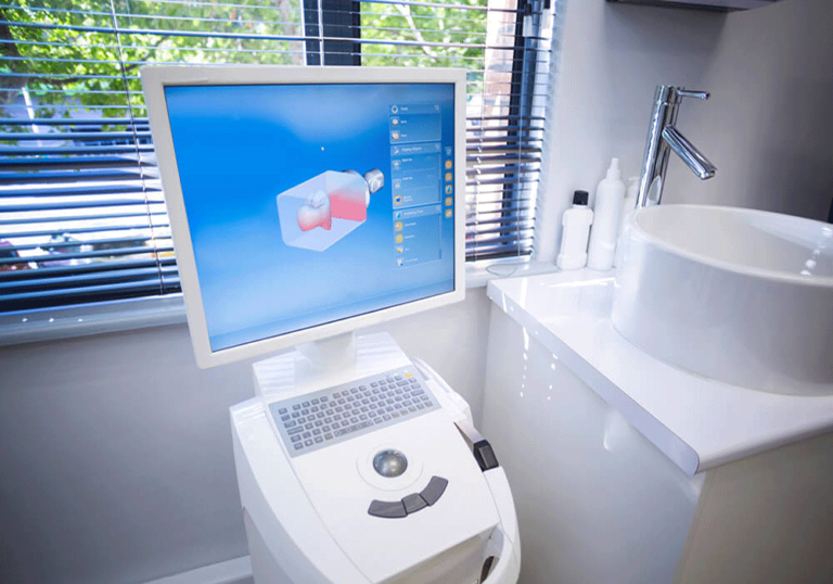 Itero Digital Scanner.